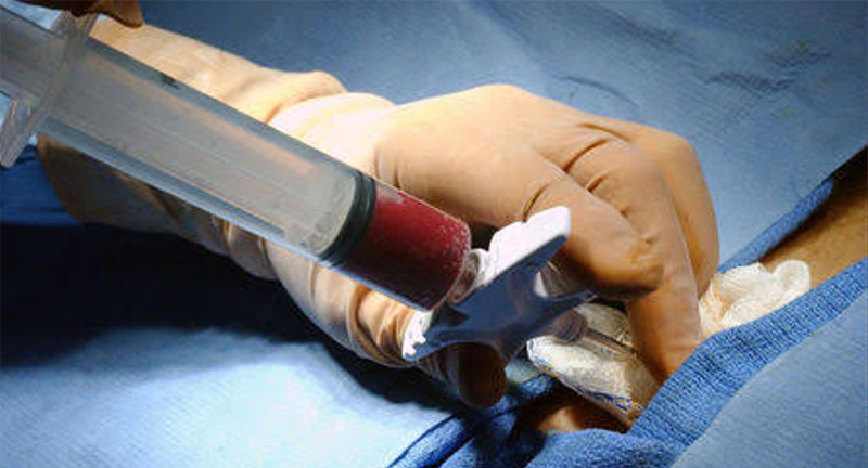 bone-marrow